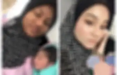 Beda 180 Derajat! Sebelumnya Miliki Wajah Putih Mulus, Kulit Perempuan Ini Berubah Gelap Hingga Tak Bisa Dikenali Saat Hamil, Ternyata Hal Inilah yang Terjadi