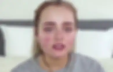 Kulit Bakal Gampang Jerawatan Kalau Lakukan 7 Kesalahan Makeup Ini!