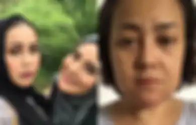 Jadi Korban Malpraktik Klinik Kecantikan, Wajah Rency Milano Turun ke Bawah, Bibir dan Dagu Kakak Elma Theana Keluarkan Nanah dan Mengeras