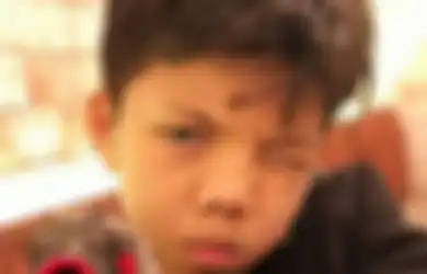 Nangis Sesenggukan Hampir Digigit Kuda, Adik Kandung Atta Halilintar Wajahnya Memar, Gen Halilintar: Ya Allah Ampunkan Kami
