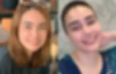 Dikira Biasa Saja, 2 Minggu Perut Terasa Kembung Hingga Tak Doyan Makan, Artis Cantik Ini Tak Menyangka di Tubuhnya Ada Tumor Ganas Bersarang, Begini Kisahnya