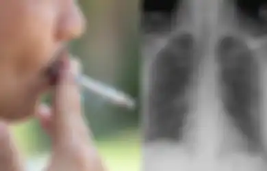 Waspada, Perokok Pasif Gampang Tertular Virus Corona dari Para Penghisap Rokok Aktif di Sekitarnya, Ternyata Begini Penjelasan Ahli