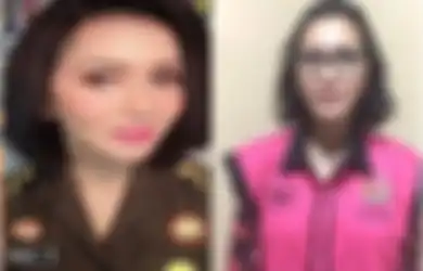 Gaji Tak Seberapa Tapi Mampu Operasi Plastik di Luar Negeri, Jaksa Pinangki Disebut Lakukan Lobi Kelas Elit, MAKI: Level Bukan di Pinggiran