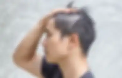 Inilah 7 Penyebab Rambut Rontok pada Cowok serta Cara Ngatasinnya