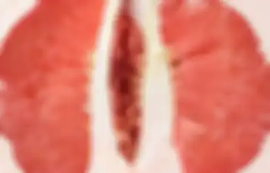 Benjolan Bisa Muncul di Vagina! Selain Herpes, Ini 5 Penyebab Lainnya!