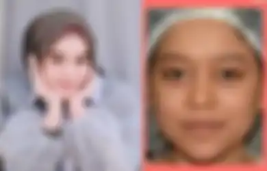 Masih Muda Sudah Permak Wajah, Perubahan Muka Lesti Kejora yang Mencolok Jadi Sorotan, Inul Daratista: Dulu Jelek Sekarang Cantik Itu Sah! 