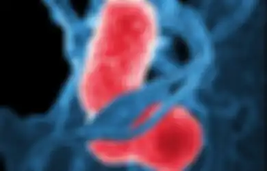 Mengenal Pneumonia, Indonesia Peringkat Ke-7 Dunia Kematian Balita karena Penyakit Ini