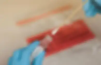 Apa Kelebihan dan Kekurangan Rapid Test Antigen untuk Cek COVID-19?