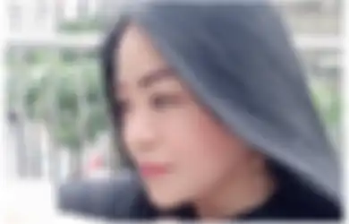 Gara-gara Kecelakaan Hingga Hidungnya Patah, Anisa Bahar Malah Kecanduan untuk Terus Lakukan Operasi 'Gonta-ganti' Bagian Tubuh: Sampai Otot Dibikin...