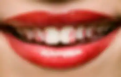 Malu-Maluin, Ini 4 Cara Biar Lipstik Enggak Nempel di Gigi Kita!
