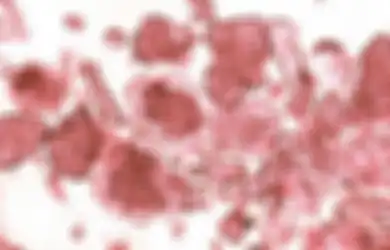 Efek Infeksinya Bisa Rusak Otak hingga Tingkat Kematian 75 Persen, Pakar Mikrobiologi Unair Beberkan Dampak Bahaya Virus Nipah: Berpotensi Bakal Jadi Pandemi Baru