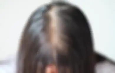 Biar Tidak Botak, Begini 4 Tips Menumbuhkan Anak Rambut di Area Jidat