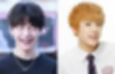 7 Idol KPop Ini Terlihat Imut Pakai Behel Saat Udah Debut. Gemes!