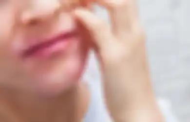 Gatal Digigit Nyamuk? Atasi dengan 4 Bahan untuk Obat Oles Ini!