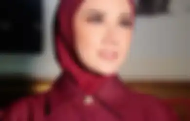 Kecantikannya Sukses Rebut Suami Rekan Duetnya Sendiri, Mulan Jameela Tiba-tiba Posting Wajah Berbintik Putih Penuh Obat, Istri Ahmad Dhani Keluhkan Alis dan Bibirnya