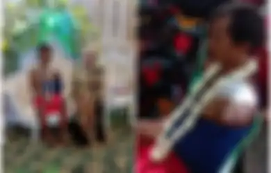 Mukanya Pasrah Duduk di Pelaminan dengan Tubuh Babak Belur, Viral Foto Pengantin Pria Penuh Luka Saat Acara Resepsi, Ternyata Ini yang Terjadi