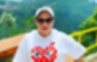  21 Kali Operasi Plastik Demi Rubah Parasnya, Penampilan Mpok Atiek Kini Bikin Pangling Pasca Angkat Silikon, Berikut Pengakuannya 