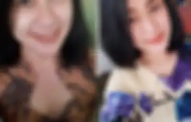 Kondisi Terakhir Eva Sofiana Wijayanti Diungkap Polisi, Wajah Perawat Cantik Rusak Karena Dibakar, Pelaku Terbirit-birit Tinggalkan Lokasi