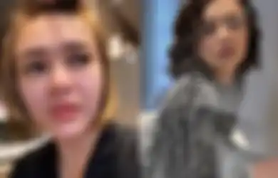 Bibirnya Disebut Dower, Amanda Manopo Dicurigai Netizen Lakukan Filler, Mantan Pacar Billy Syahputra Gercep Klarifikasi: Lagi Bermasalah Banget