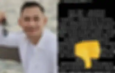 Kantongi Identitas Pelaku yang Menyerempetnya, Aktor Lucky Alamsyah Bongkar Sosoknya yang Diduga Mantan Menteri: Setelah Dikejar Dia Masuk Parkiran Stasiun TV