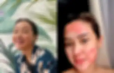 Berbaring dengan Puluhan Jarum di Tubuh, Cita Citata Ungkap Perjuangannya Obati Penyakit Autoimun: Jangan Lupa Berserah Diri Sama yang Ngasih Hidup