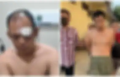 Kantongi 3 Pisau, Pria Ini Mendadak Tikam Leher Anggota Polantas, Pelaku: Teroris, Pak Teroris