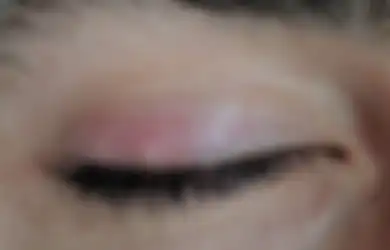 Mata Bintitan? Enggak Bersihkan Make-Up dan 3 Hal Ini Penyebabnya!