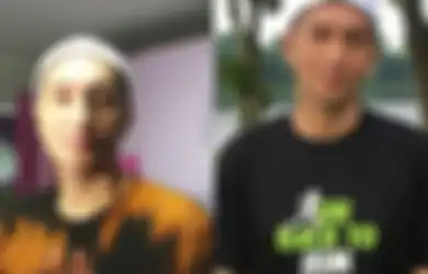 Tubuhnya Kurus Kering, Aktor Gary Iskak Tampak Terbaring di Ranjang Rumah Sakit dengan Selang di Hidung, Istri: Untuk Saat Ini...