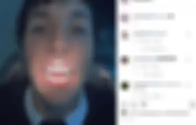 Serem Atau Keren? Oli Sykes Modifikasi Gigi Taringnya Jadi Mirip Vampir