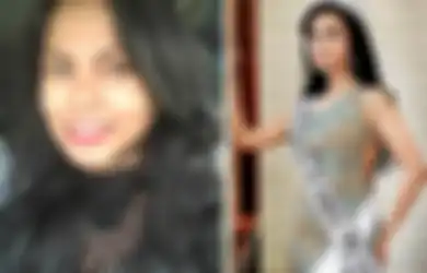 Innalillahi Wa Inna Ilaihi Rojiun, Dialami Finalis Puteri Indonesia, Penyakit Asam Lambung Bisa Renggut Nyawa, Jean Trifena Patty Meninggal di Usia Muda saat Diet Ketat