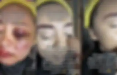 Akhirnya Terbongkar! Viral MUA Rias Wajah Calon Pengantin Wanita yang Penuh Luka Lebam, Cuma Bismillah yang Jadi Modal