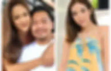 Lehernya Berkalung Lengan Seorang Wanita, Nobu Pamerkan Potret Cantik Sang Kekasih dengan Pesan Romantis, Singgung Ketegaran Pria