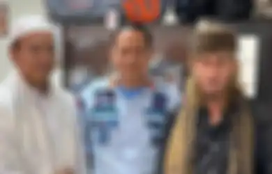Pengacara Ryan Jombang Lapor Bareskrim, Mata Korban Bogem Mentah Habib Bahar bin Smith Masih Bengkak dalam Foto Bukti Damai