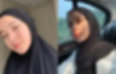 Kariernya Meredup Usai Terlibat Skandal Hubungan Terlarang dengan Ayus, Nissa Sabyan Mendadak Muncul dengan Wajah yang Dipenuhi Perban, Sang Vokalis Ungkap Kondisnya Sekarang