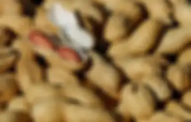 Mitos atau Fakta: Benarkah Makan Kacang Bisa Membuat Wajah Menjadi Jerawatan?