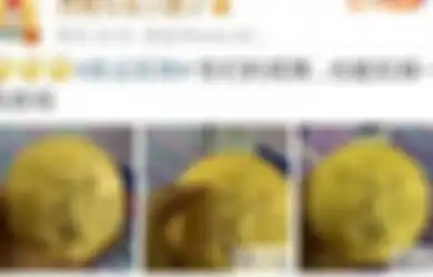 Noda Kecil Makin Besar hingga Terkelupas, 2 Atlet China Ini Sampai Tak Berani Pegang Lagi Medali Emas Olimpiade Tokyo 2020 Miliknya, Terungkap Fakta Sebenarnya yang Bikin Syok