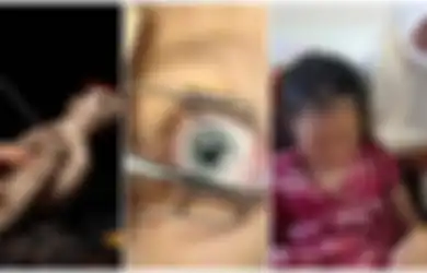 Kini Berada di RSJ, Ibu yang Cungkil Mata Kanan Anaknya Teriak-teriak Minta Tumbal, Paman Korban Ungkap Fakta Ini