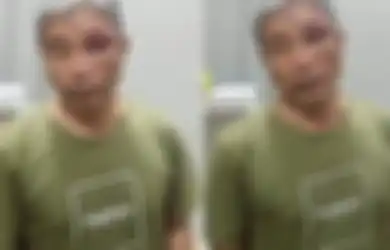 Disebut Lumuri Muhammad Kece dengan Tinja, Jenderal Napoleon Bonaparte Ungkap Fakta Sebenarnya, Foto Tampang Bengap Sang YouTuber Jadi Bukti