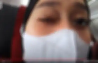 Terlihat di Kamera, Mata Lesti Kejora Tampak Lebam dan Berwarna Biru, Istri Rizky Billar Mengeluh Sakit hingga Ungkap Hal Ini