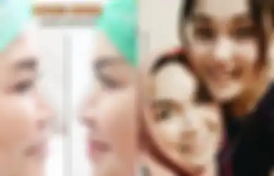 Permak Wajah Habis Rp 100 Juta, Begini Transformasi Penampilan Ibunda Ayu Ting Ting Setelah Perawatan, Dagu dan Pipinya Berubah