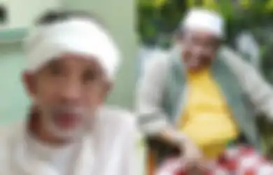 Ingat Komedian Nurul Qomar? Dulu Terjerat Kasus Pemalsuan Ijazah, Kini Berjuang Lawan Kanker Stadiun 4, Begini Kondisinya Pasca Operasi Besar