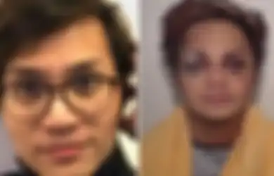 Setahun Mendekam di Penjara dengan Vonis Seumur Hidup, Foto Babak Belur Reynhard Sinaga Mendadak Dirilis ke Publik, Ini yang Terjadi