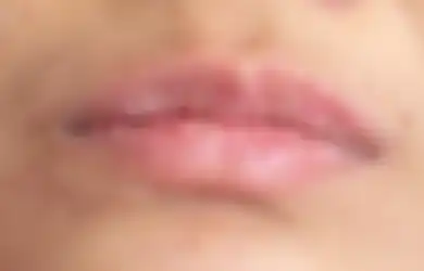 Bibir Kering dan Pecah-pecah Bikin Risih dan Kurang Pede, Ini 3 Bahan yang Ampuh Untuk Mengatasinya
