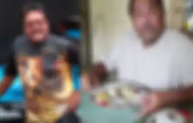 Kini Hidup Tanpa Empedu, Rano Karno Ngaku Sampai Dilarang Lakukan Aktivitas Berat oleh Keluarga, Dokter Ungkap Makanan yang Mudah Ditemui di Indonesia Ini Diduga Jadi Penyebab Utamanya