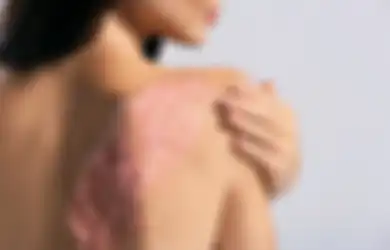 Enggak Jadi Mulus, Ini 5 Kesalahan Fatal saat Pakai Body Scrub!