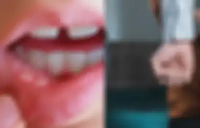 Wali Murid Keroyok Guru SD di Bengkulu Sampai Polisi Turun Tangan, Singgung Murid yang Sedang Sariawan, Ternyata Masalahnya Berawal dari Ini