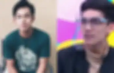 Muncul ke Publik Ngaku Jadi Korban Kecelakaan Gaga Muhammad, Valfero Muzamil Ungkap Cerita Pilu Dimana Wajahnya Sempat Penyok Sampai Butuh 3 Tahun untuk Pulih