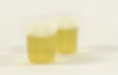 Urine Berbusa, Haruskah Khawatir? Dehidrasi dan 3 Hal Ini Penyebabnya!