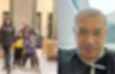 Dokter Bongkar Rasa Sakit yang Bakal Diterima Anang Hermansyah Saat Proses Transplantasi Rambut, Sampai Harus Dibantu Suntikan Ini