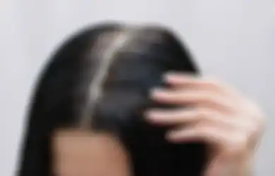 Waduh, Sudah Ubanan Sejak Remaja? Ternyata Gara-Gara Hal Ini!